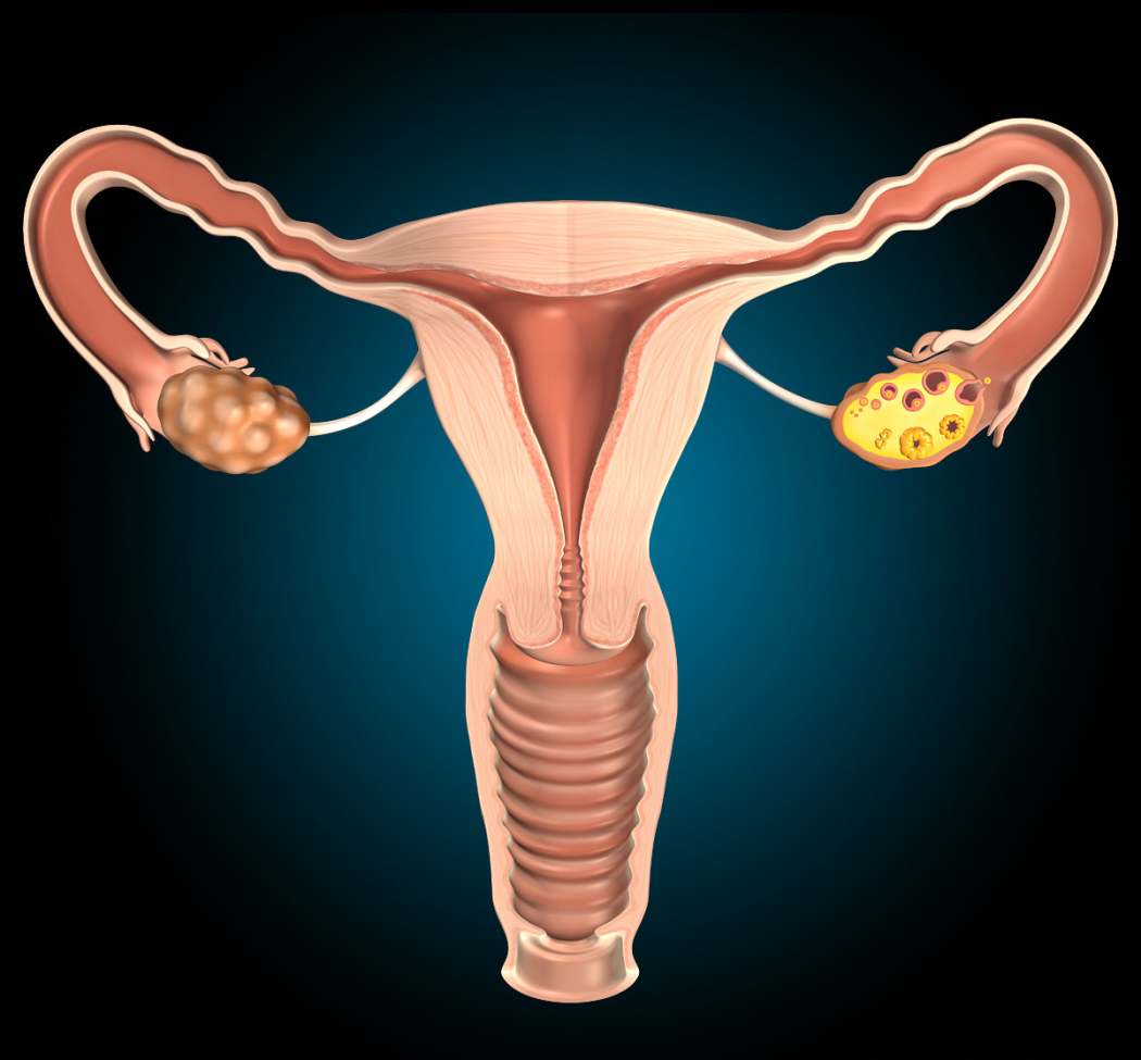 Женские органы матка